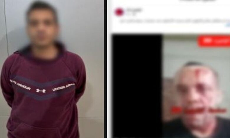 إصابة